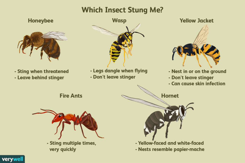 What Should I Do If I Get Stung By A Bee?