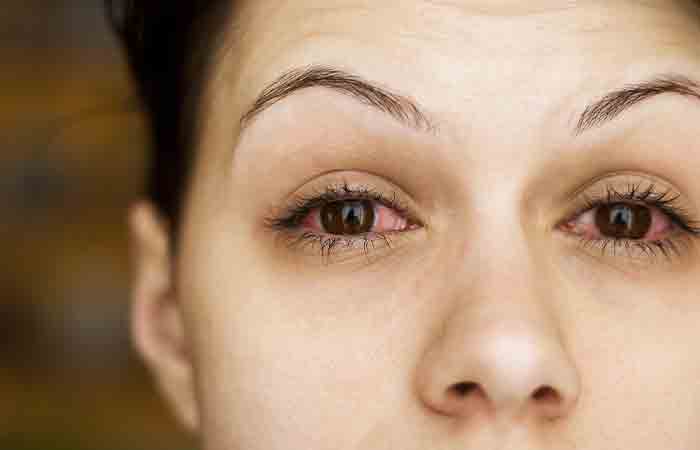 How To Use Manuka Honey On Eyelids